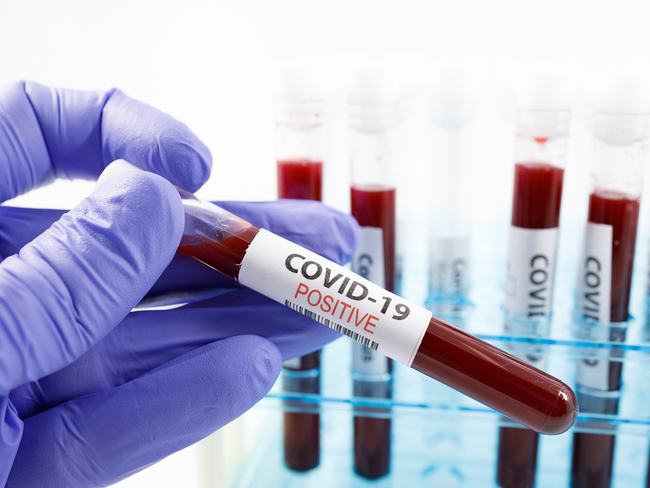Covid-19 sample 100